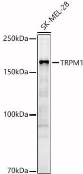 TRPM1 Antibody - Azide and BSA Free