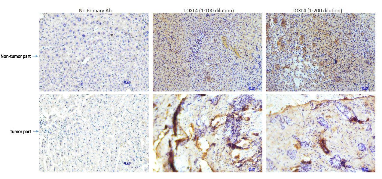 LOXL4 Antibody