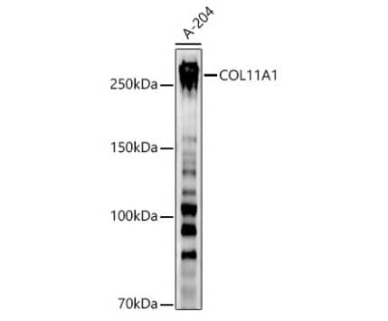 COL11A1 Antibody - BSA Free