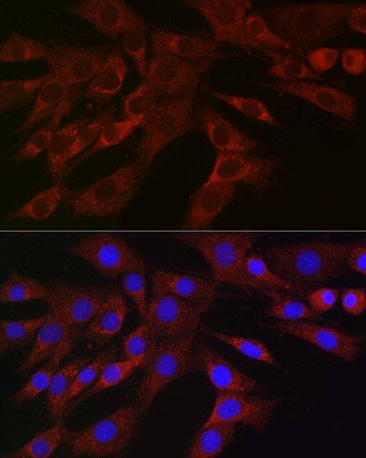 PLK2 Antibody