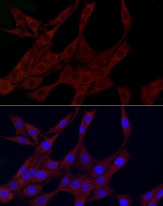 PLK2 Antibody