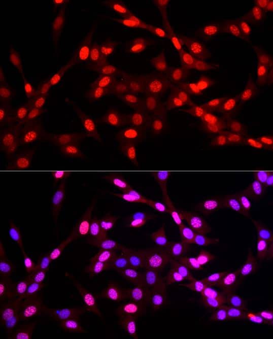 KLF6 Antibody - BSA Free