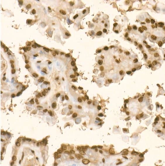 KLF6 Antibody - BSA Free
