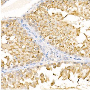 KIF3A Antibody - BSA Free