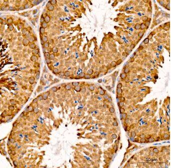 CHAC1 Antibody - Azide and BSA Free
