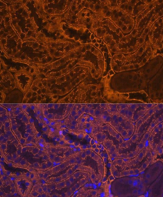 pan Cadherin Antibody (2M6G8)