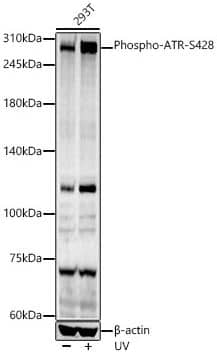 ATR [p Ser428] Antibody