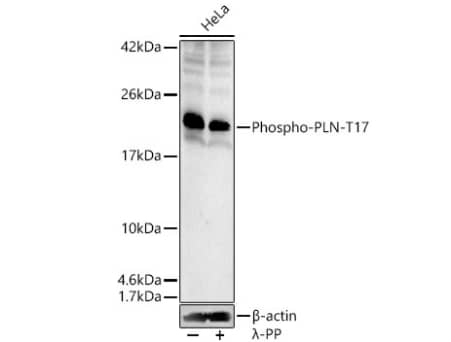 Phospholamban [p Thr17] Antibody - Azide and BSA Free