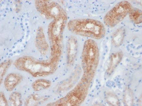 PSMA/FOLH1/NAALADase I Antibody (FOLH1/2354)