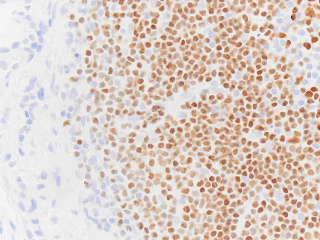 Pax5/BSAP Antibody (PAX5/3735)