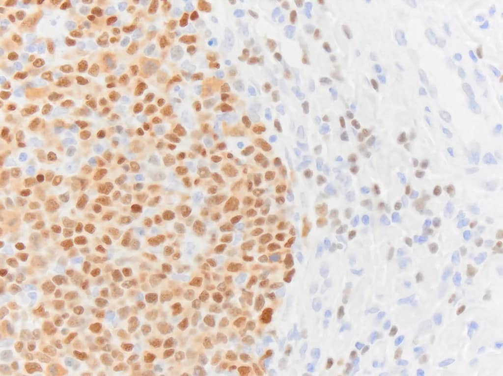 Pax5/BSAP Antibody (PAX5/3735)