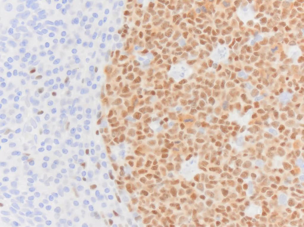 Pax5/BSAP Antibody (PAX5/3735)