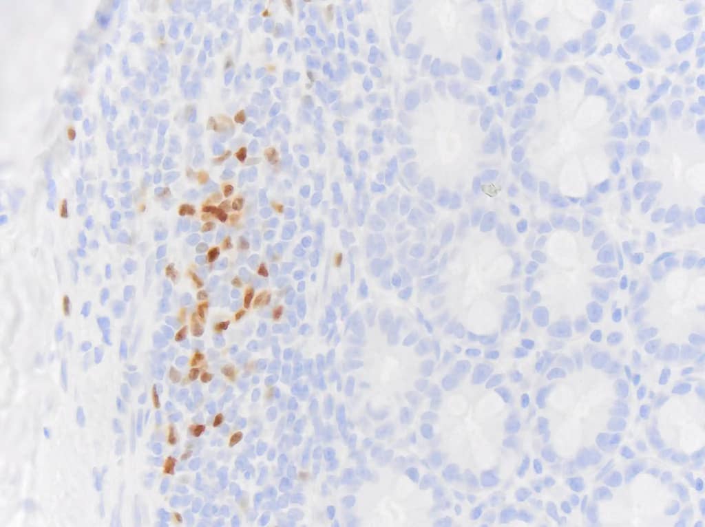 Pax5/BSAP Antibody (PAX5/3735)
