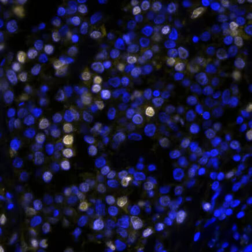 IRF4 Antibody (MUM1/8274R) - BSA Free IRF4 Antibody (MUM1/8274R) IRF4 in Human Hodgkin�s Lymphoma via seqIF� staining on COMET�