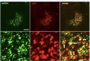 Immunohistochemistry-NBP3-11395-dsRNA Antibody (J2) - Azide and BSA Free- dsRNA Antibody (J2) - Azide and BSA Free