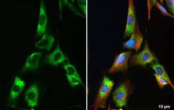 Collagen IV alpha 1 Antibody