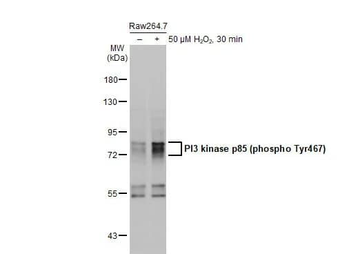 PI 3-Kinase p85 alpha [p Tyr199, p Tyr467] Antibody