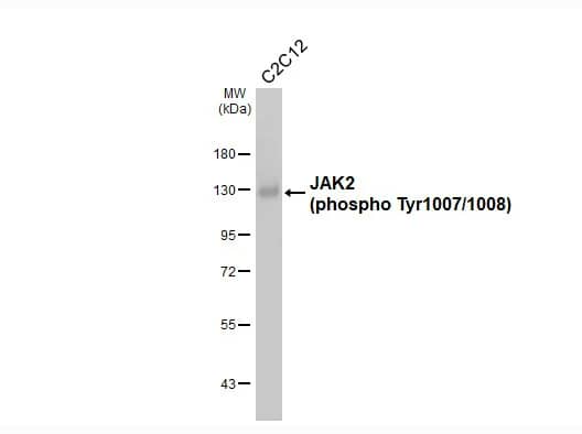 Jak2 [p Tyr1007, p Tyr1008] Antibody