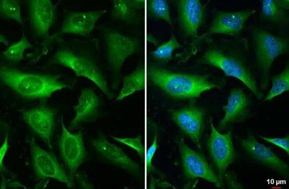 TOR/mTOR [p Ser2448] Antibody