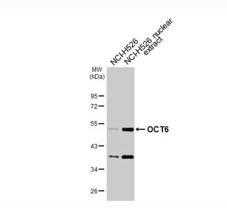 OCT6 Antibody - BSA Free
