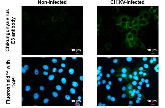 Chikungunya Virus E3 Antibody