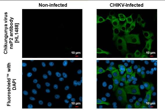 Chikungunya Virus E1 Antibody