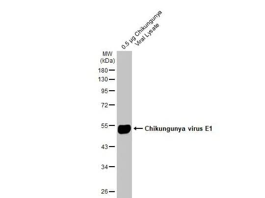 Chikungunya Virus E1 Antibody