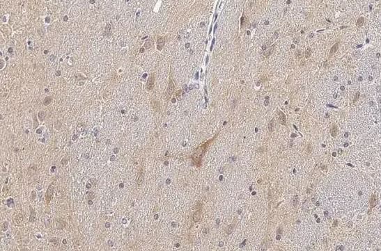 Tau [p Thr217] Antibody