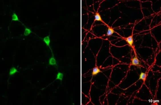 C9orf72 Antibody (GT779-RB)
