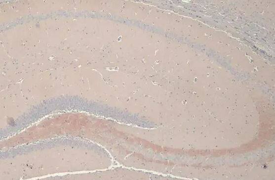 C9orf72 Antibody (GT779-RB)