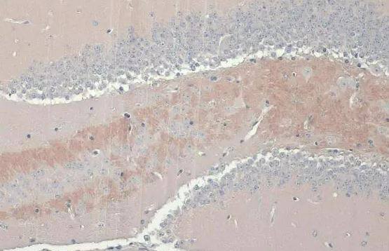 C9orf72 Antibody (GT779-RB)