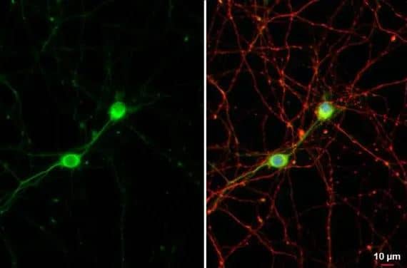 C9orf72 Antibody (GT1553-RB)