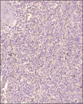 CD5 Antibody (7.8) - BSA Free