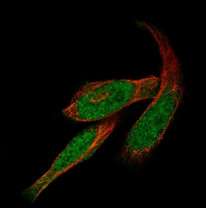 GLI-1 Antibody (CL12191)