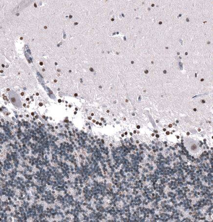 GLI-1 Antibody (CL12191)