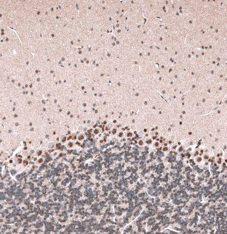 GLI-1 Antibody (CL12191)