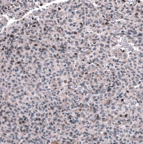 GLI-1 Antibody (CL12191)