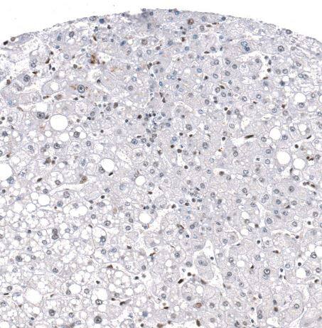 GLI-1 Antibody (CL12191)