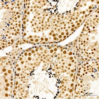 Smad2 [p Ser467] Antibody - Azide and BSA Free
