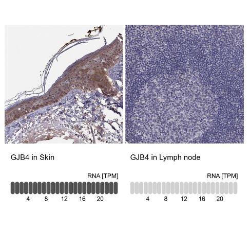 Connexin 30.3/GJB4 Antibody