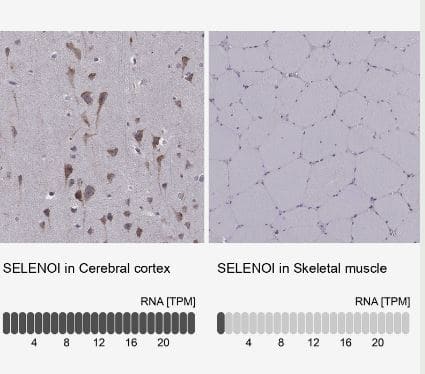 SELI Antibody