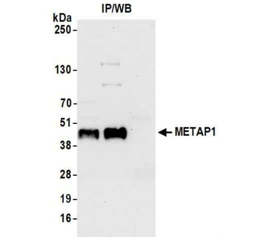 Methionine Aminopeptidase 1/METAP1 Antibody