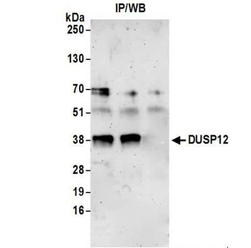 DUSP12 Antibody