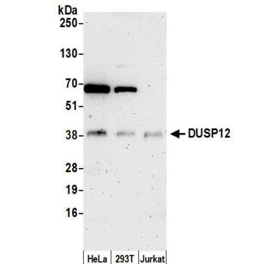 DUSP12 Antibody