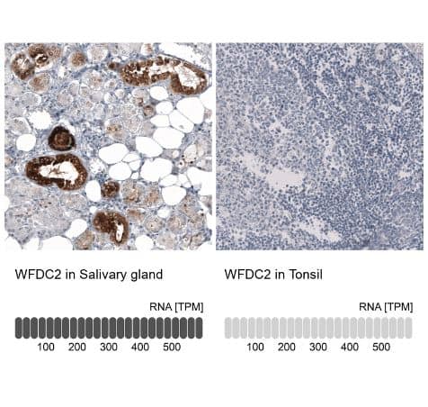 HE4/WFDC2 Antibody (CL12917)