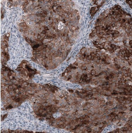 HE4/WFDC2 Antibody (CL12917)