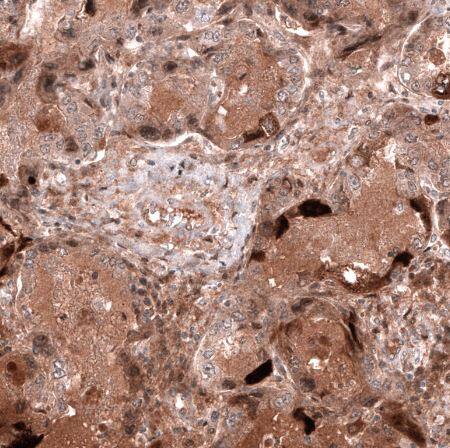 HE4/WFDC2 Antibody (CL12917)