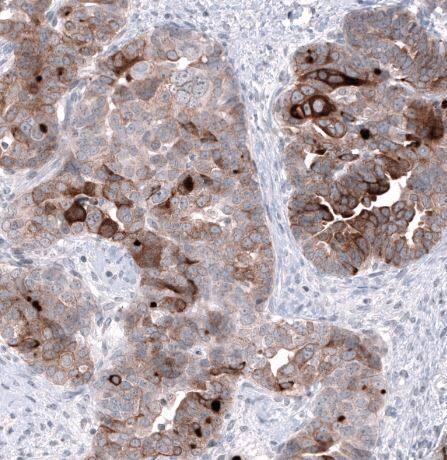 HE4/WFDC2 Antibody (CL12917)