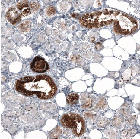 HE4/WFDC2 Antibody (CL12917)