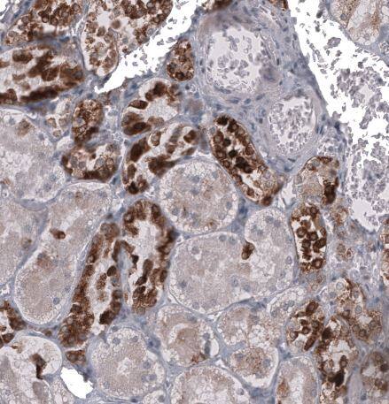 HE4/WFDC2 Antibody (CL12917)